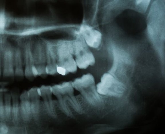oralchirurgie.jpg 