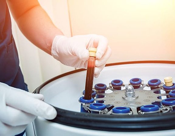 platelet-rich-fibrin.jpg